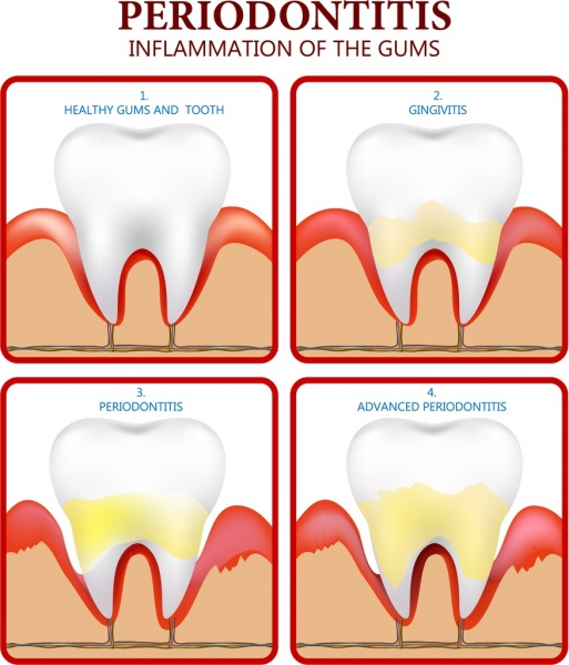 Parodontologie-Plakat flach farbige Design-Zahn-Ikonen