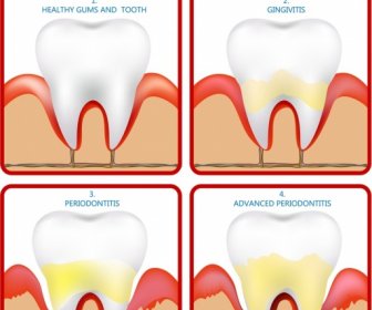 Periodontics Poster Flat Colored Design Tooth Icons