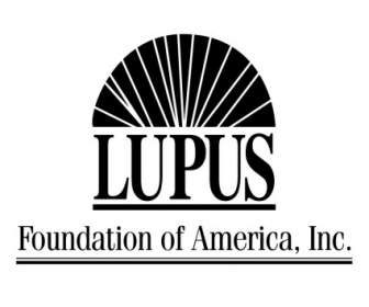 Fondamento Di Lupus Dell'america